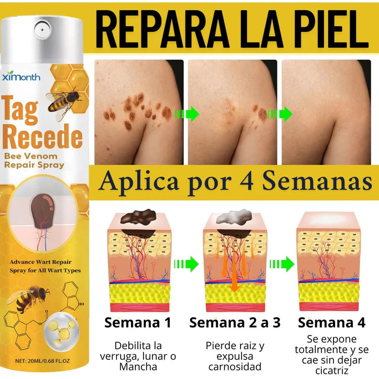 Eliminador De Verrugas ¡Tag Recede!